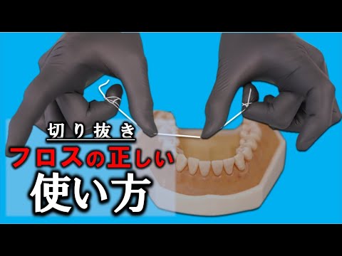 【 切り抜き 】フロスの使い方　私の考え！　※　使用法は症例によって変わります！ぜひご担当の先生にご相談下さいね！　＃歯医者 ＃フロス