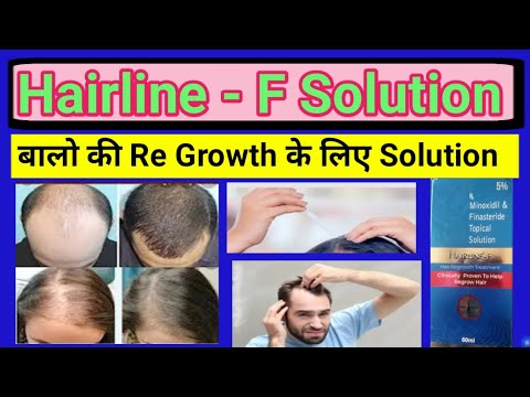 How to use HAIRLINE F Solution Minoxidil #cngajbhiye #harline f solution