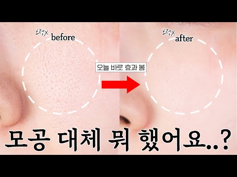 10년차 홈케어 전문가가 알려주는 큰 모공 줄이는 꿀팁🙋🏻‍♀️ 딱 10분 만에 깐달걀 피부 되는 비법 대방출⏰