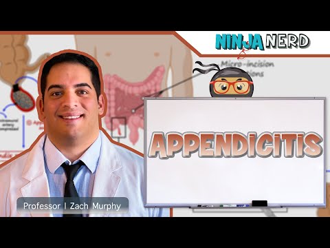 Appendicitis | Clinical Medicine