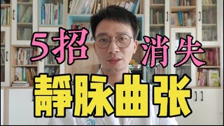 静脉曲张消失了！揭秘腿部静脉曲张的原因、先兆，教你5招赶走下肢静脉曲张！人老腿先老，看你下肢有没有血管瘀堵的先兆！