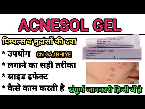 How to use Acnesol Gel, Acnesol gel uses, Side effects in hindi #CNGAJBHIYE  #acnesolgel