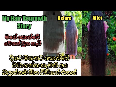 My Hair Journey /How to grow hair faster /Hair Care Sinhala /Hair Regrowth Journey