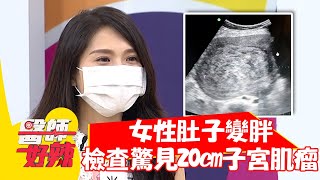 女性肚子變胖，檢查驚見「20cm子宮肌瘤」？！【#醫師好辣】20210819 part2 EP1186 陳榮堅 徐小可