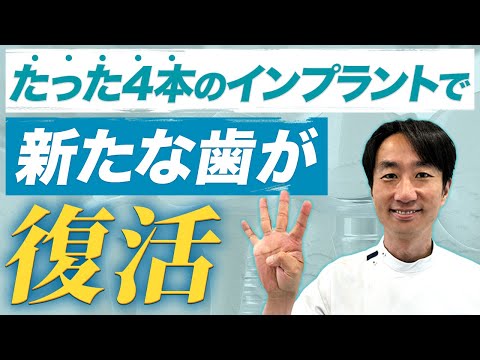 【オールオン4】わずか4本のインプラントで全ての歯が治る治療法⁉