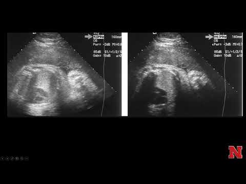 Ultrasound2BasicDisplay