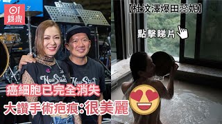 杜汶澤爆田蕊妮癌細胞已完全消失 貼沐浴照大讚手術疤痕：很美麗｜01娛樂｜田蕊妮｜肺腺癌