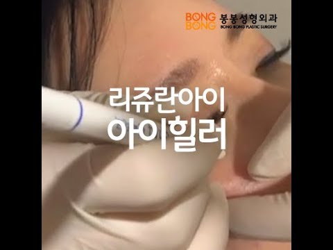 리쥬란 힐러 아이👁