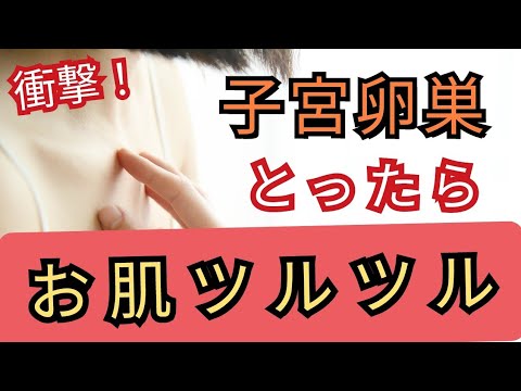 【子宮卵巣摘出】最良のメリットと医師から知らされないデメリットを教えます《体験者様の声をご紹介》