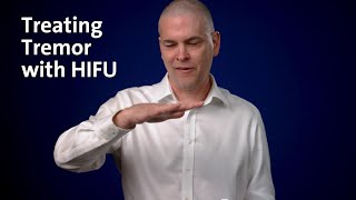 HIFU: An Outpatient Procedure for Essential Tremor