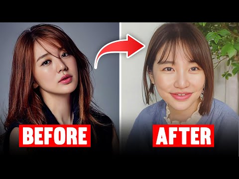 10 Korean Celebrity Plastic Surgery Disasters 2024!