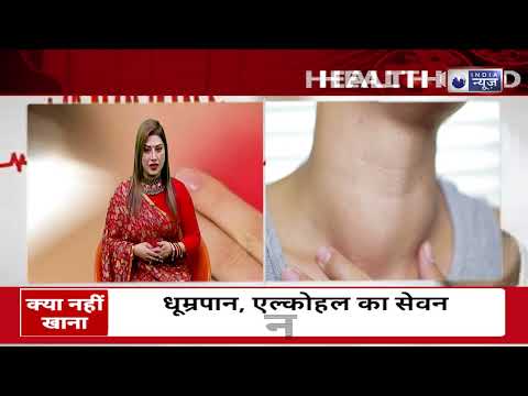 THYROID - HOMOEOPATHIC TREATMENT - Prof.  Dr.A.K.Gupta of AKGsOVIHAMS