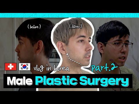 Advanced genioplasty - Male plastic surgery in Korea