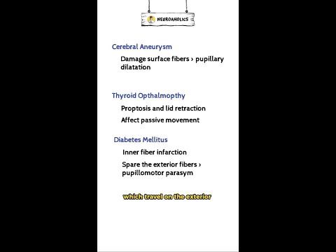 Ischemic third nerve palsy case discussion | Neuroaholics #short #shorts