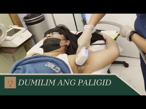 Ang kilikili ni Mikay, may pag-asa pa bang pumuti?! || ToRo Family