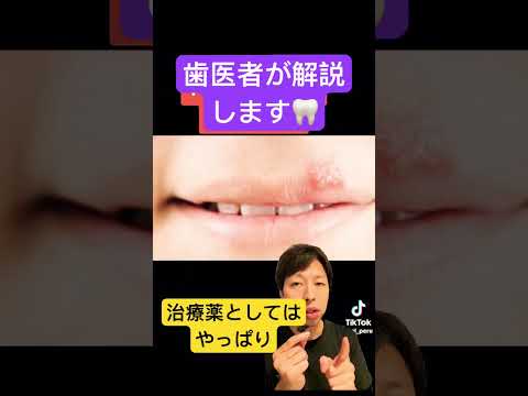 口内炎。何とかしたい🦷#stomatitis #口内炎 #応急処置 #治療 #早く治す #歯医者 #薬 #方法 #歯科衛生士 #歯科助手 #豆知識 #生理食塩水