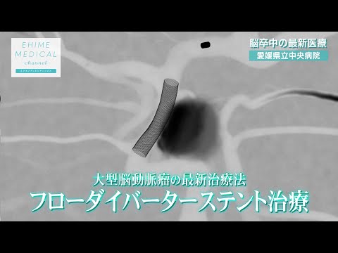 「脳卒中～最新医療篇～」EHIME MEDICAL channel(2月15日放送)