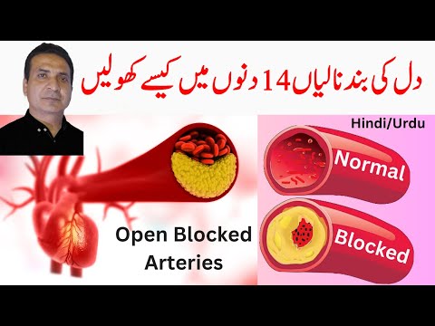 How to Open Blocked Arteries In 14 Days | Treatment By Food #DrAbbasOfficial