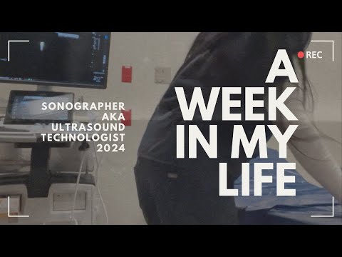 A productive week in my life as a sonographer 2024 (ultrasound technologist)