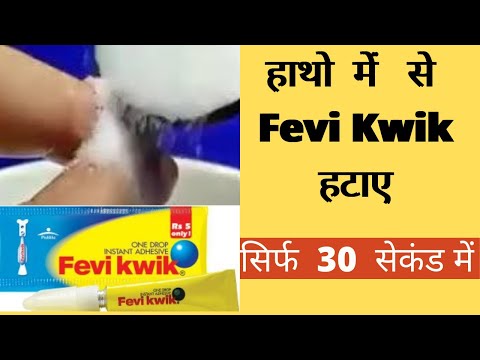 how to fevi kwick remove from hand | Tips to remove fevi kwick from finger |