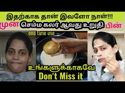 உங்கள வெய்யிலுக்கு காட்டாம்ம வளர்தாங்களானு கேட்பாங்க!!!...Full body whitening pack...