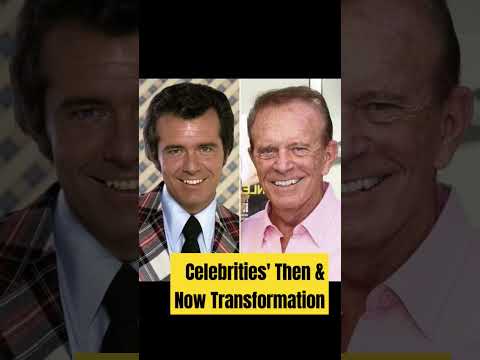 Celebrities' Then & Now Transformation#hollywood#viral#shorts