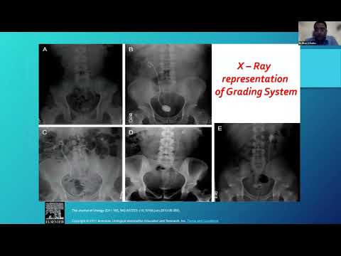 WEBINAR ON RIRS