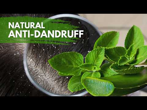 Natural Home Remedy for Dandruff