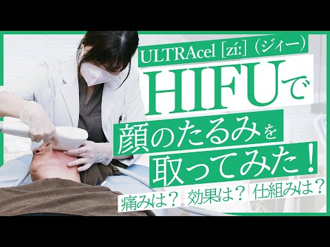 【たるみ】お肌をグッと引き締める。HIFUで顔のたるみを取ってみた！施術後の驚きの結果に！？【リフトアップ】