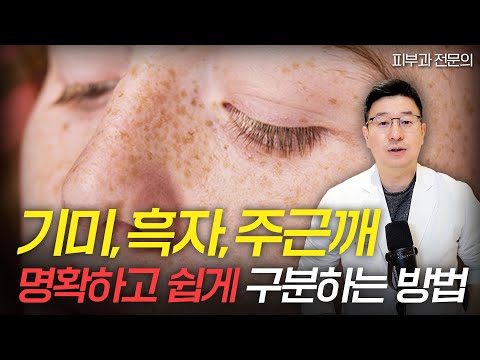 I'll explain how to clearly distinguish between melasma, lentigines, freckle, other facial blemishes