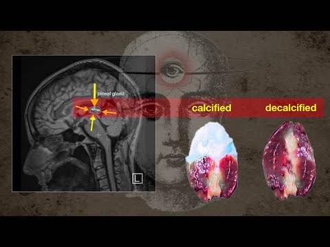 I finally decalcified my pineal gland! Here's how