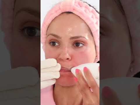 Clear Your Skin Of Acne And Dark Spots | Skin Care Routine