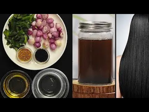 100% गारंटी 10 गुना तेजी से बढ़ेंगे आपके बाल||Extreme hair growth oil||Hair oil for severe hair fall