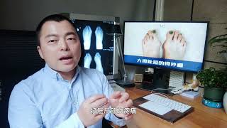 拇外翻疼痛，大脚骨拇囊炎疼痛的原因和治疗方案-bunions