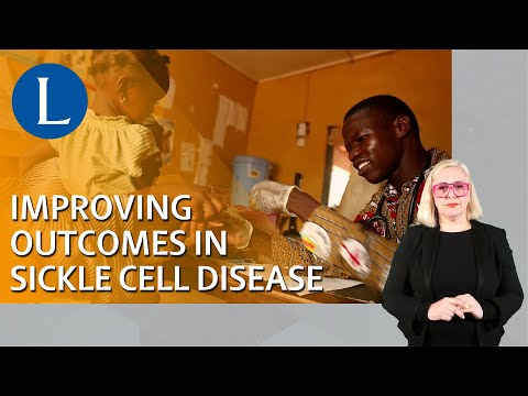 Improving outcomes in sickle cell disease (BSL-interpreted)