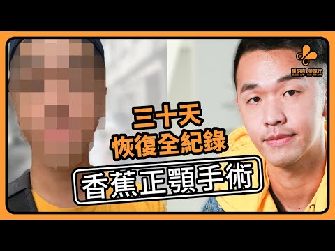 謝明吉醫師-香蕉超震撼正顎手術恢復過程，首度公開！！！