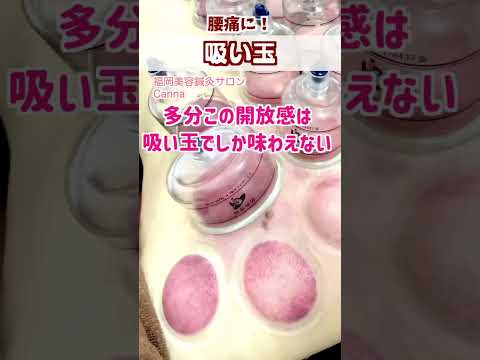 【腰痛】吸い玉で腰痛改善！