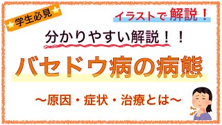 教科書をわかりやすく！「バセドウ病の病態」〜原因や症状、治療のメカニズムを解説！〜