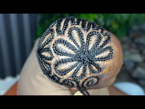 BRAIDED BALDIE 😍😍