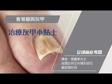 繫退灰甲真菌，預防復發有辦法– Pedorthic Technology 足科矯形