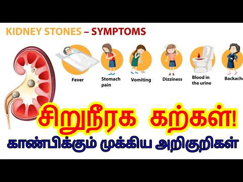 Kidney stone pain location on body in tamil | kidney stone symptoms in tamil | kidney stone tamil