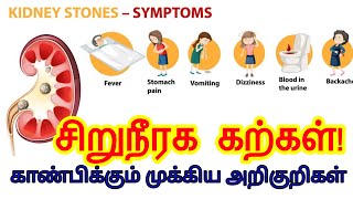 Kidney stone pain location on body in tamil | kidney stone symptoms in tamil | kidney stone tamil