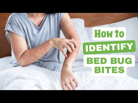 How to Identify Bed Bug Bites: Your Ultimate Guide to Detecting and Dealing with Them