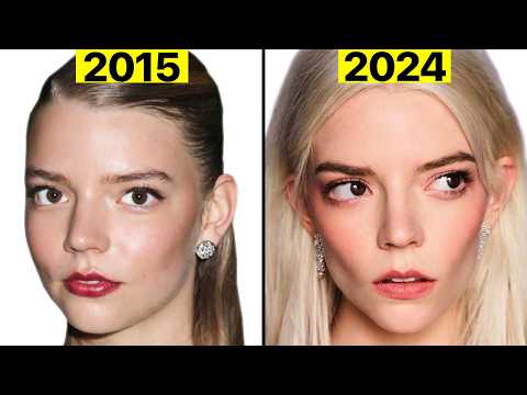 Anya Taylor-Joy's NEW Face Transformation | Plastic Surgeon Reacts