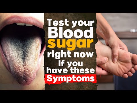 Test your Blood Sugar right now If you have these symptoms | Diabetes Symptoms. Blood Sugar test