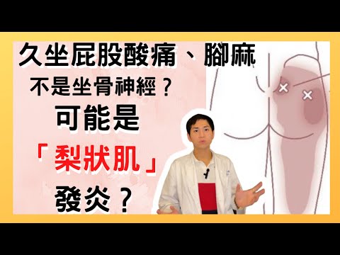 ［5分鐘改善］久坐屁股痛、腳麻?只需2招有效改善?