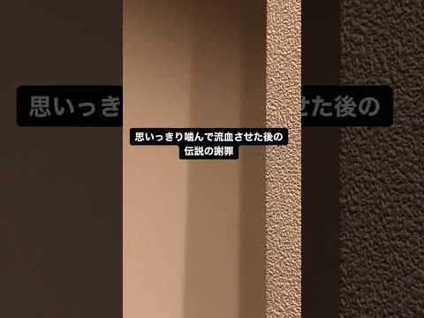 ヨウムにかまれた飼い主、「ごめんなさいは？」と言うと……　コントのような爆笑の返し