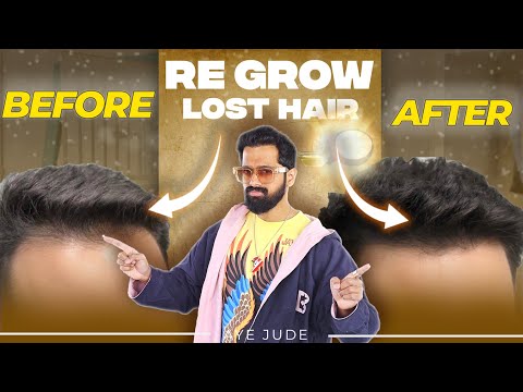 How to Regrow LOST HAIR (5 ways)