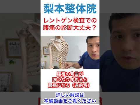 ”レントゲン問題なし”は危険！？ #shorts