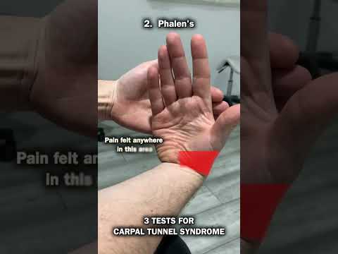 3 Tests For Carpal Tunnel Syndrome!